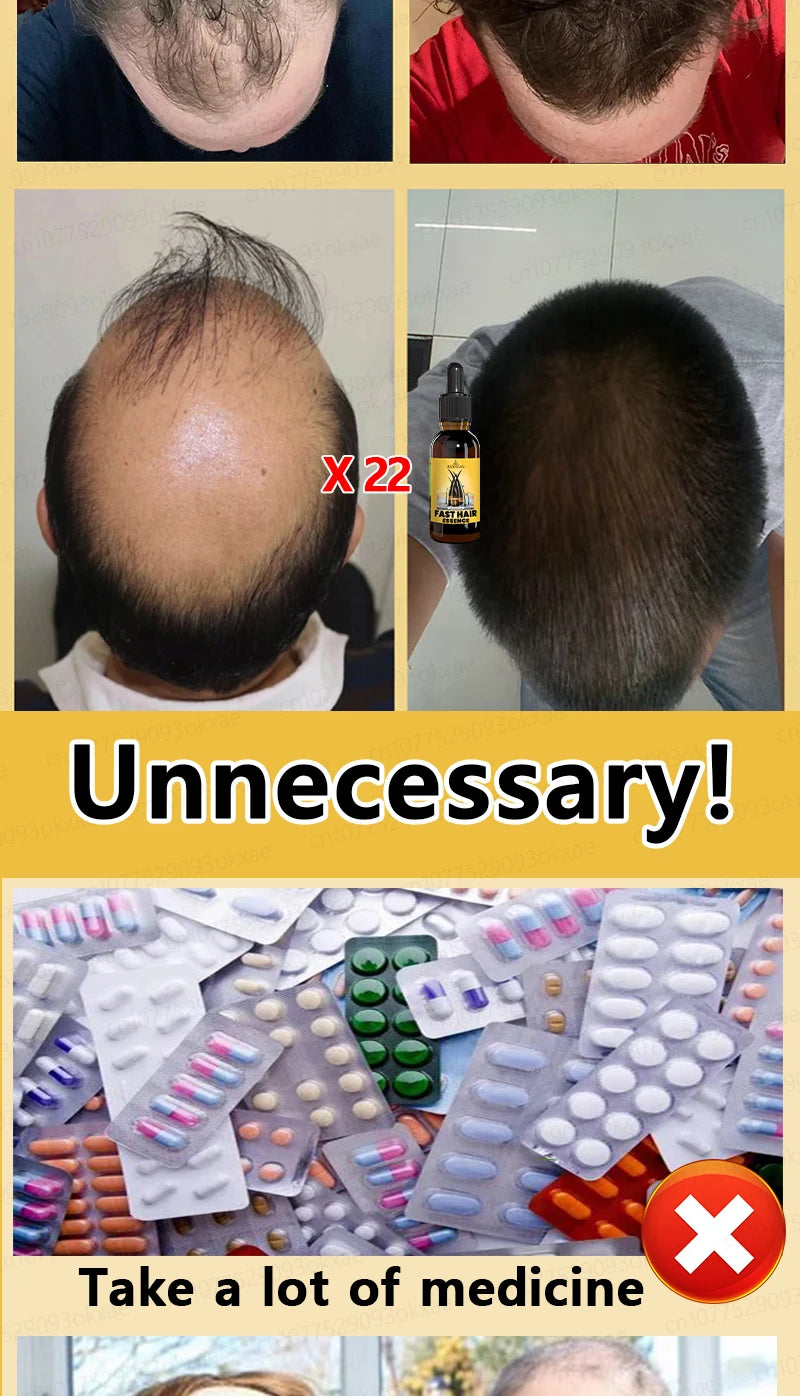 Want to say goodbye to hair loss? Our hair growth products can penetrate the scalp, promote hair growth, and help you regain you