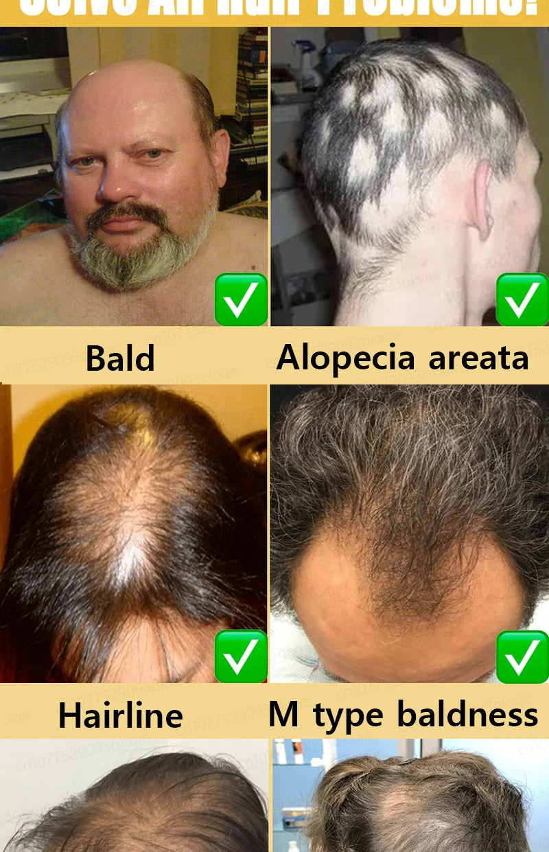 Want to say goodbye to hair loss? Our hair growth products can penetrate the scalp, promote hair growth, and help you regain you