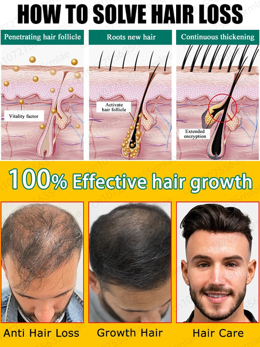 Want to say goodbye to hair loss? Our hair growth products can penetrate the scalp, promote hair growth, and help you regain you