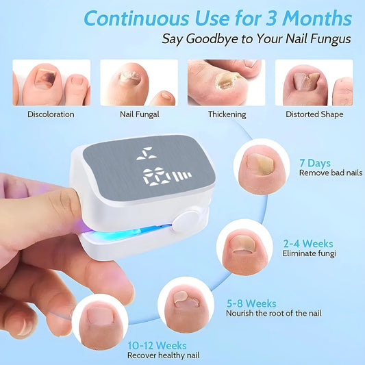 Nail Fungus Treatment Tools Fungal Nail Treatment Device Anti-Equipment Effectively Remove Fungal Toenail Nail Fungal Infection