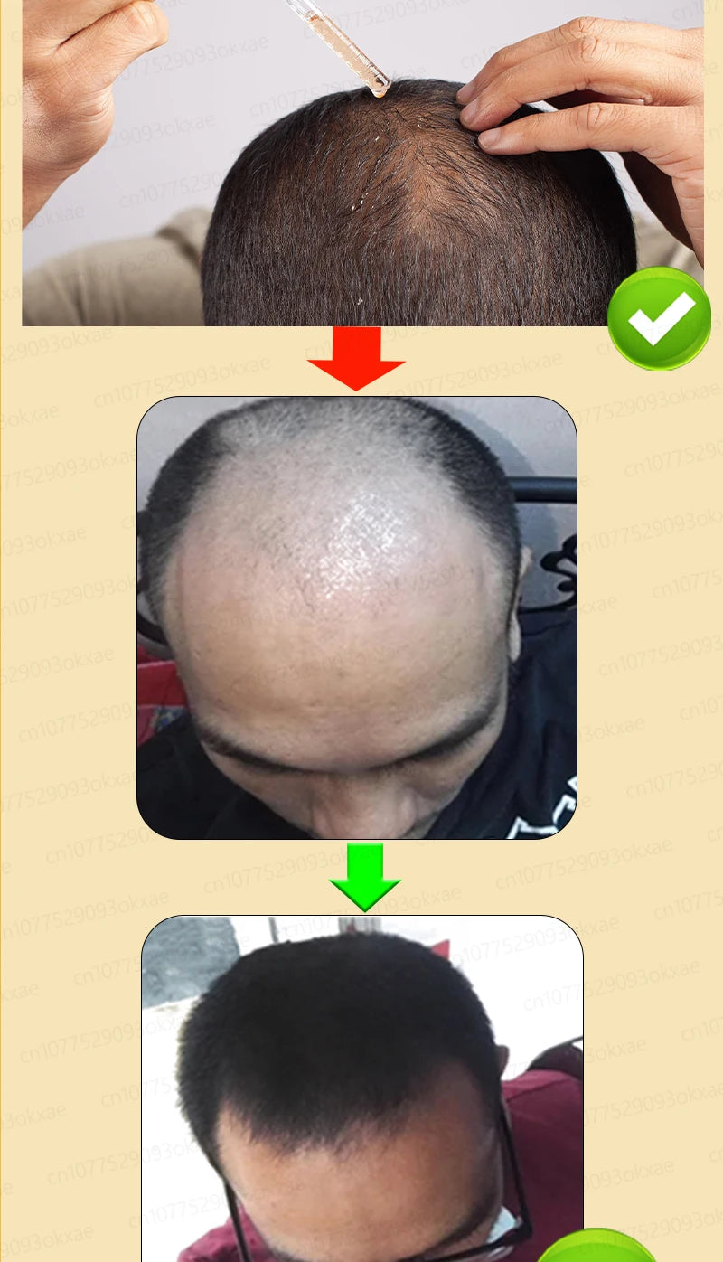 Want to say goodbye to hair loss? Our hair growth products can penetrate the scalp, promote hair growth, and help you regain you