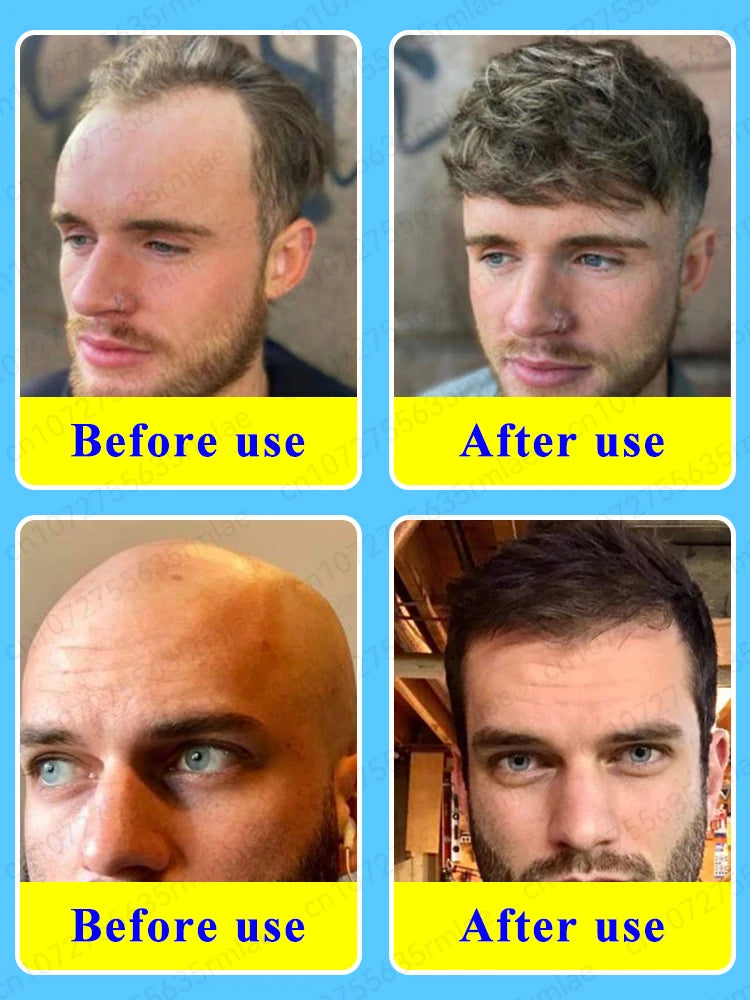Want to say goodbye to hair loss? Our hair growth products can penetrate the scalp, promote hair growth, and help you regain you