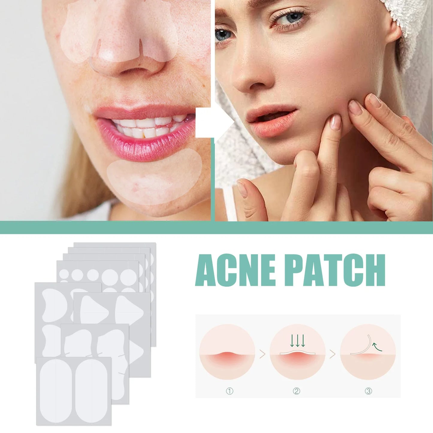 132Pcs Acne Pimple Patches Skin Blemish Treatment Patches Professional Face Cleaning Care Invisible Large Hydrocolloid Sticker
