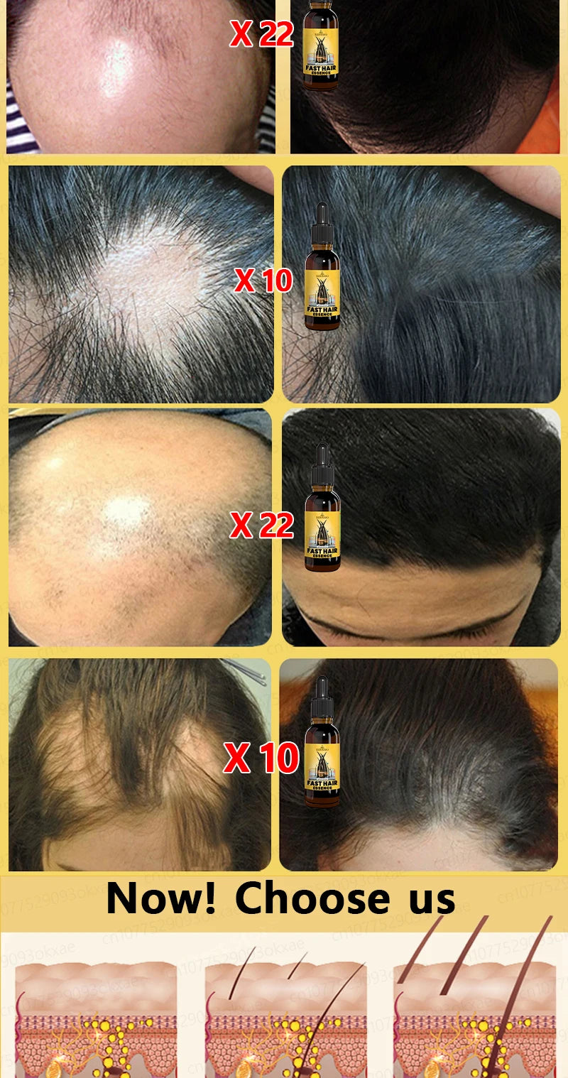 Want to say goodbye to hair loss? Our hair growth products can penetrate the scalp, promote hair growth, and help you regain you