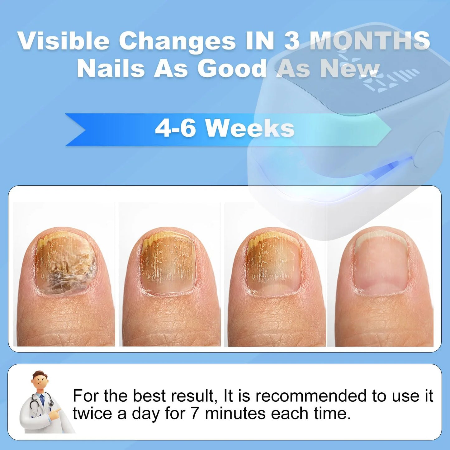 Nail Fungus Treatment Tools Fungal Nail Treatment Device Anti-Equipment Effectively Remove Fungal Toenail Nail Fungal Infection