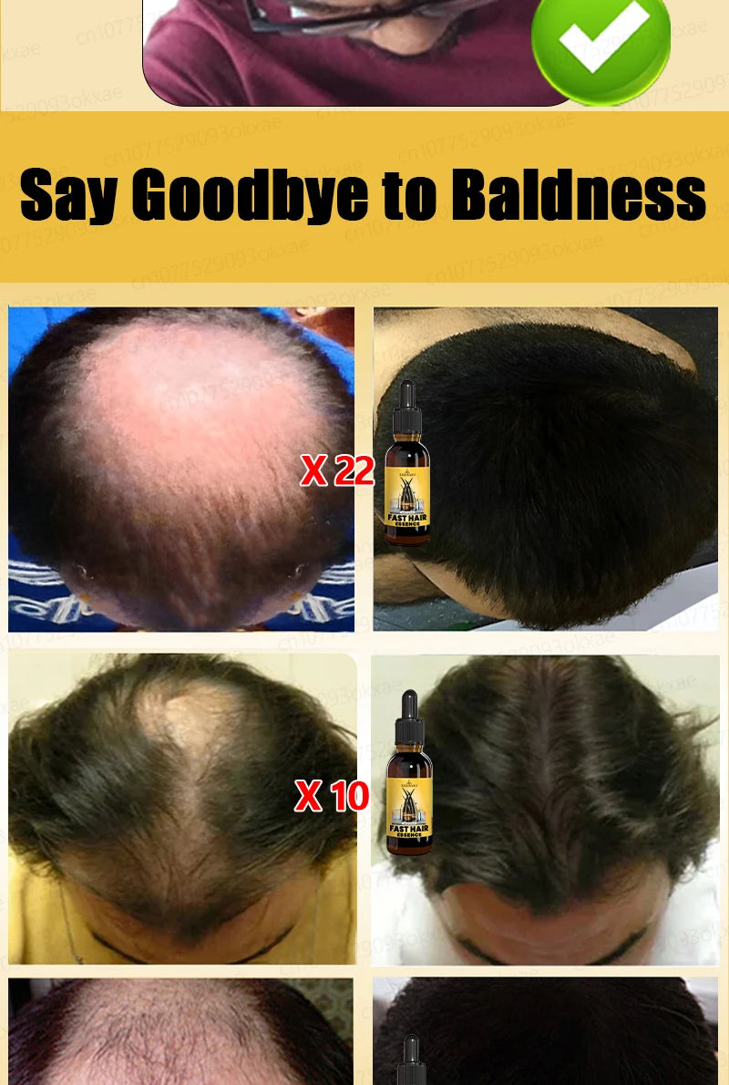 Want to say goodbye to hair loss? Our hair growth products can penetrate the scalp, promote hair growth, and help you regain you
