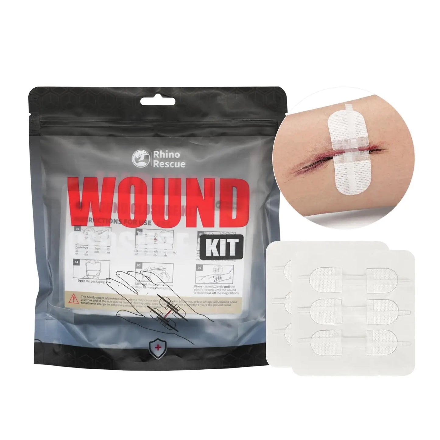 RHINO RESCUE Zip Stitch 6pcs with Wound Dresssings, Wound Closure Strips Without Suture, Zipstitch Laceration Closure Kit