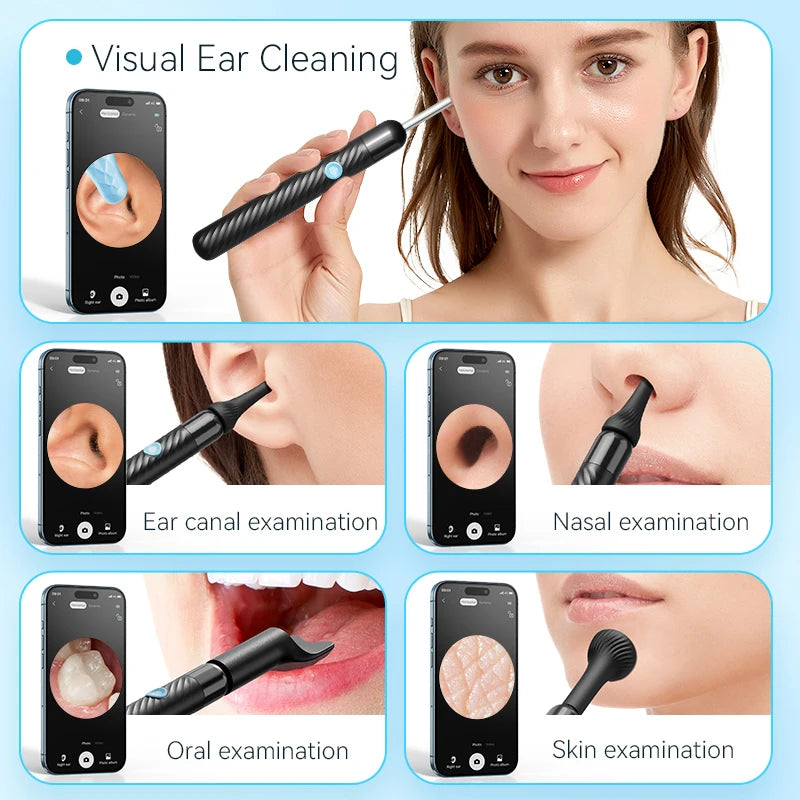 Wireless Ear Wax Removal With Camera Rechargeable Ear Cleaner 8 Megapixels Ear Check Camera with 6 Pcs Ear Spoon Set Canal Clean