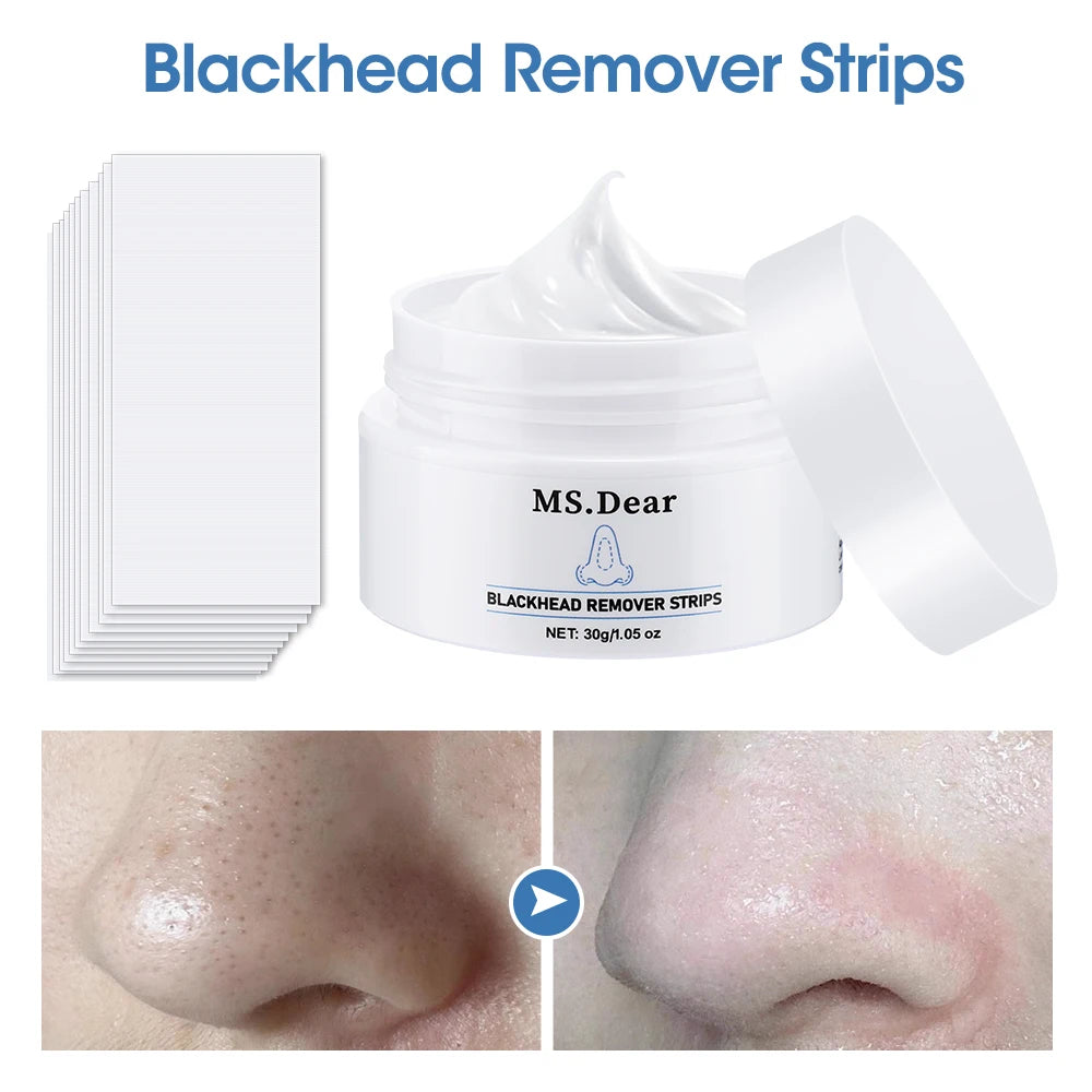 Nose Blackhead Remover Cream Pore Strip Tearing Mask Peeling Acne Cleaner Nasal Patch Black Dots Deep Deaning Skin Care Makeup