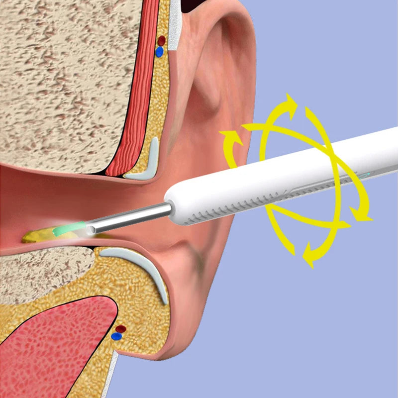 1-9pcs/Set Visual Ear Cleaner with Camera Ear Sticks USB Charging Ear Wax Removal Tool WIFI Connection 6 LED Lights Earpick