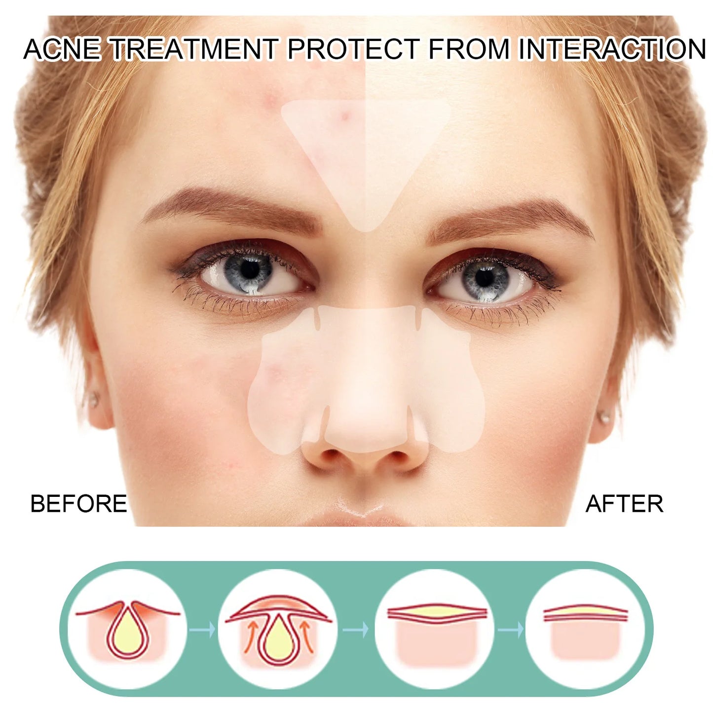 132Pcs Acne Pimple Patches Skin Blemish Treatment Patches Professional Face Cleaning Care Invisible Large Hydrocolloid Sticker