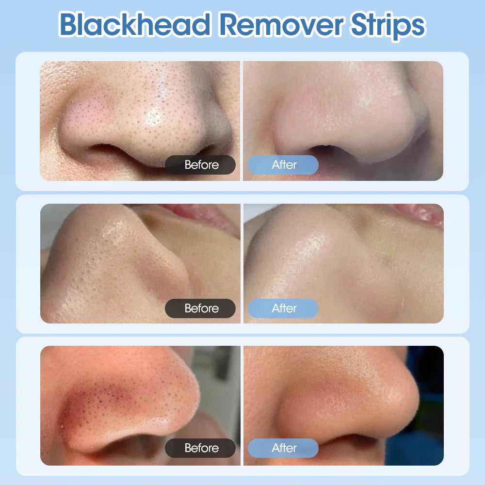 Nose Blackhead Remover Cream Pore Strip Tearing Mask Peeling Acne Cleaner Nasal Patch Black Dots Deep Deaning Skin Care Makeup