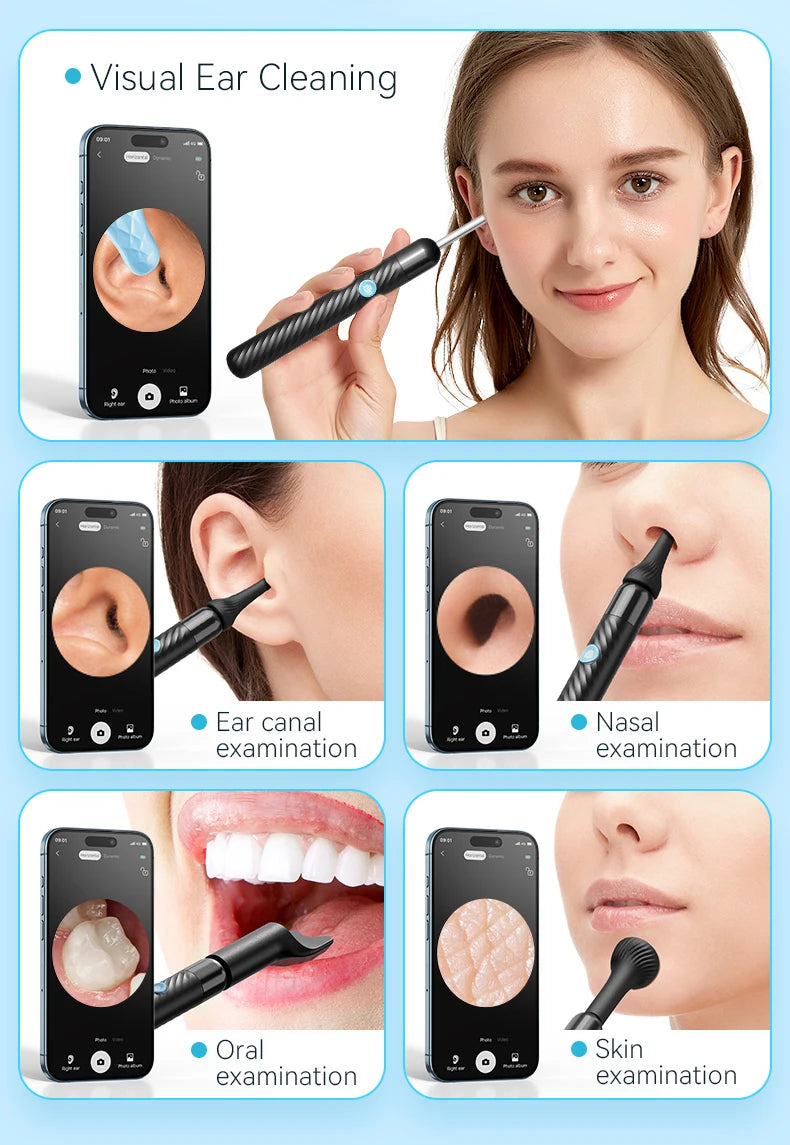 Wireless Ear Wax Removal With Camera Rechargeable Ear Cleaner 8 Megapixels Ear Check Camera with 6 Pcs Ear Spoon Set Canal Clean