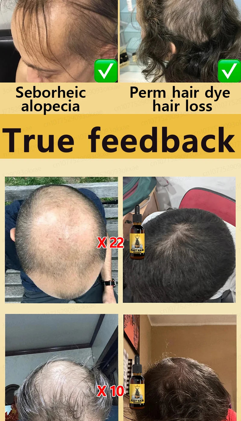 Want to say goodbye to hair loss? Our hair growth products can penetrate the scalp, promote hair growth, and help you regain you