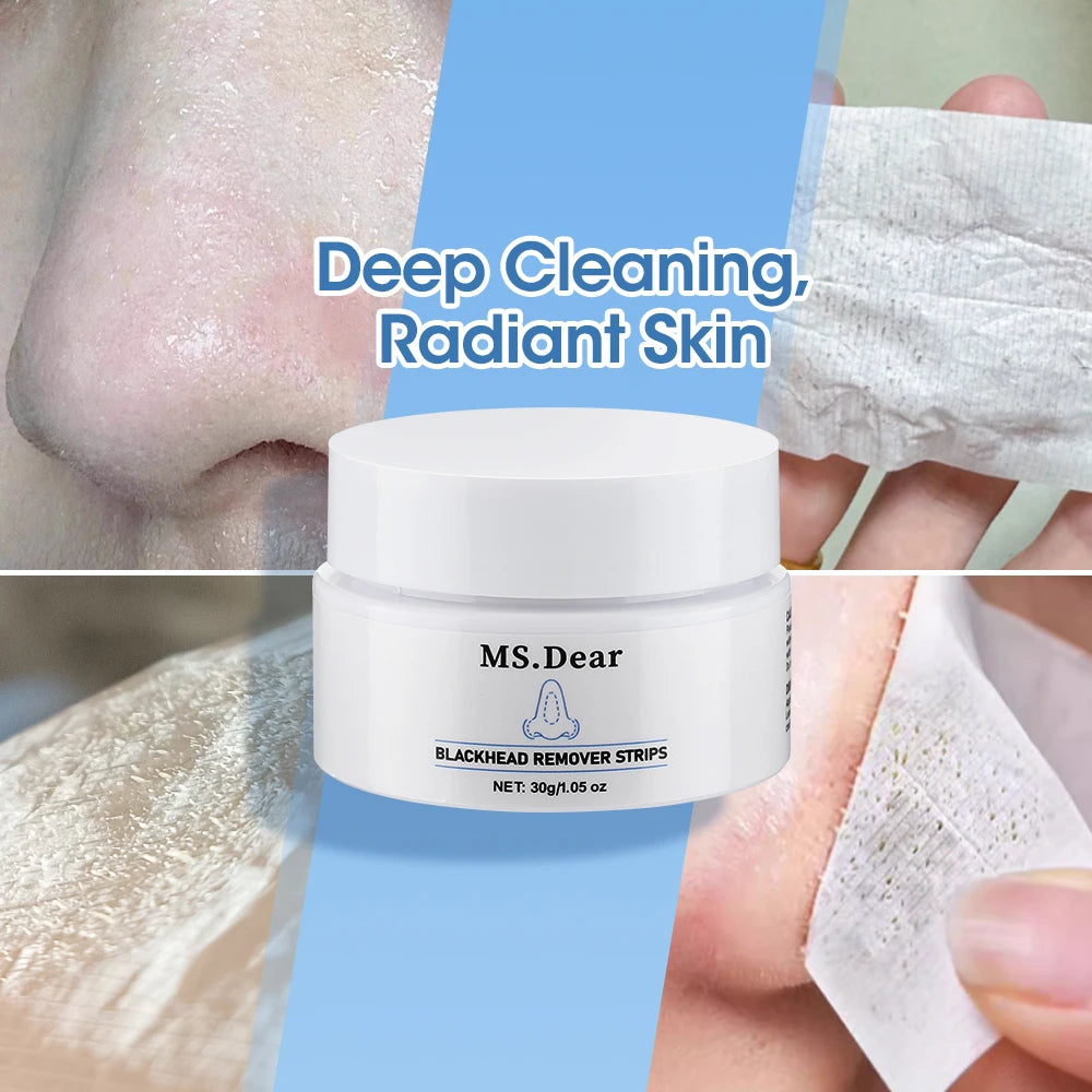 Nose Blackhead Remover Cream Pore Strip Tearing Mask Peeling Acne Cleaner Nasal Patch Black Dots Deep Deaning Skin Care Makeup