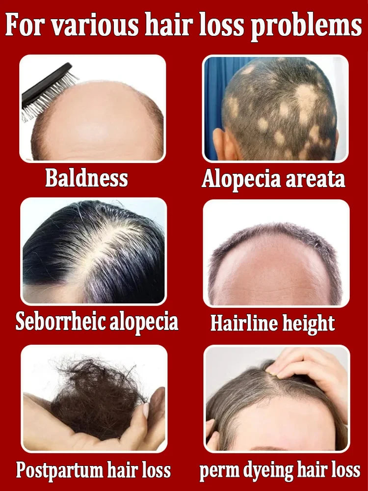 Want to say goodbye to hair loss? Our hair growth products can penetrate the scalp, promote hair growth, and help you regain you