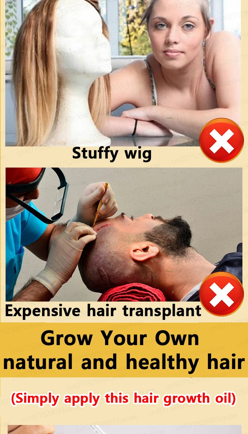 Want to say goodbye to hair loss? Our hair growth products can penetrate the scalp, promote hair growth, and help you regain you