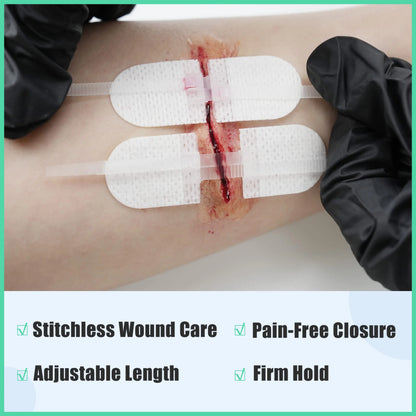 RHINO RESCUE Zip Stitch 6pcs with Wound Dresssings, Wound Closure Strips Without Suture, Zipstitch Laceration Closure Kit