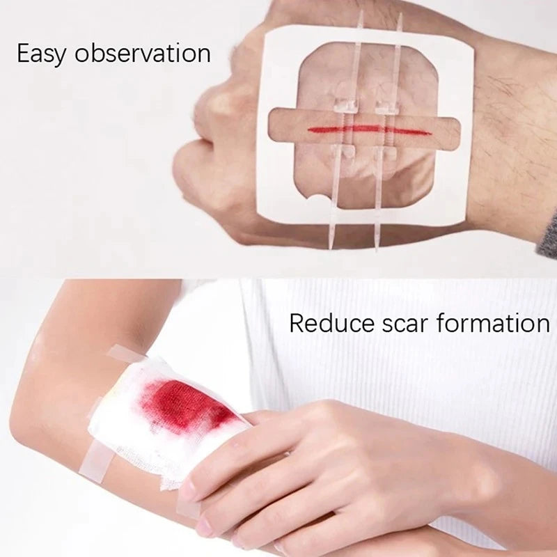 2-10 adhesive bandages with zipper, wound closure device, no need for sutures, quick and painless, outdoor medical care