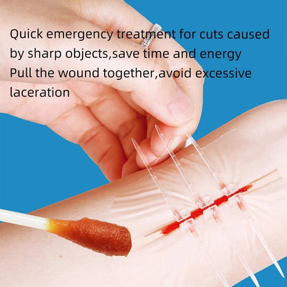 2-10 adhesive bandages with zipper, wound closure device, no need for sutures, quick and painless, outdoor medical care