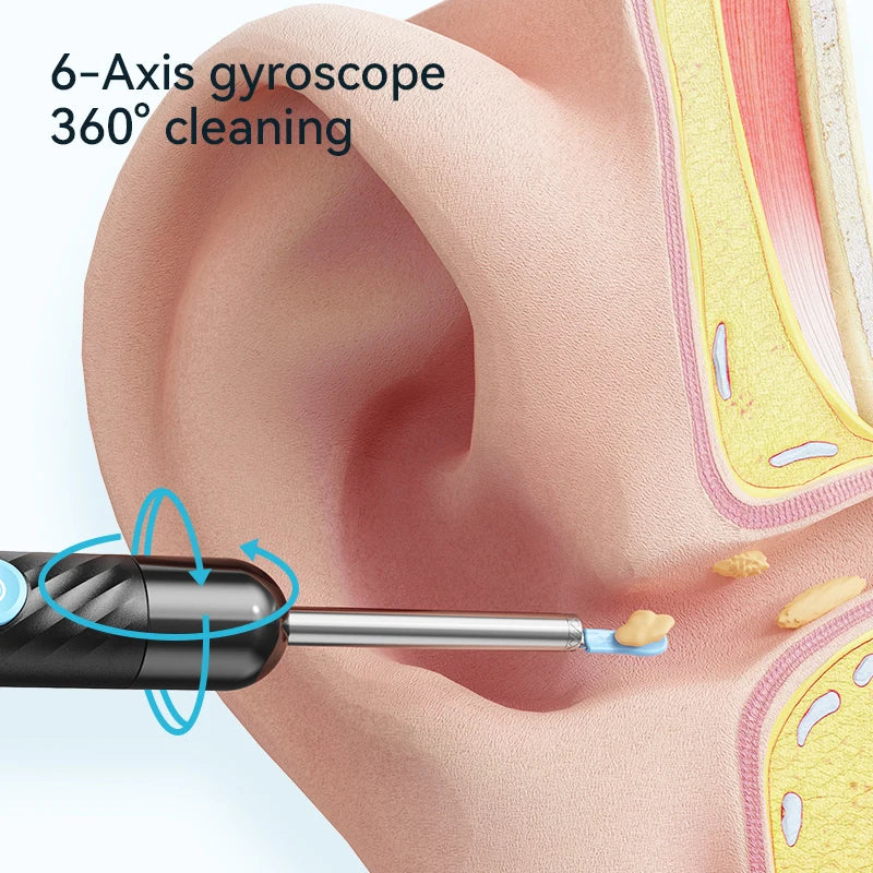Wireless Ear Wax Removal With Camera Rechargeable Ear Cleaner 8 Megapixels Ear Check Camera with 6 Pcs Ear Spoon Set Canal Clean