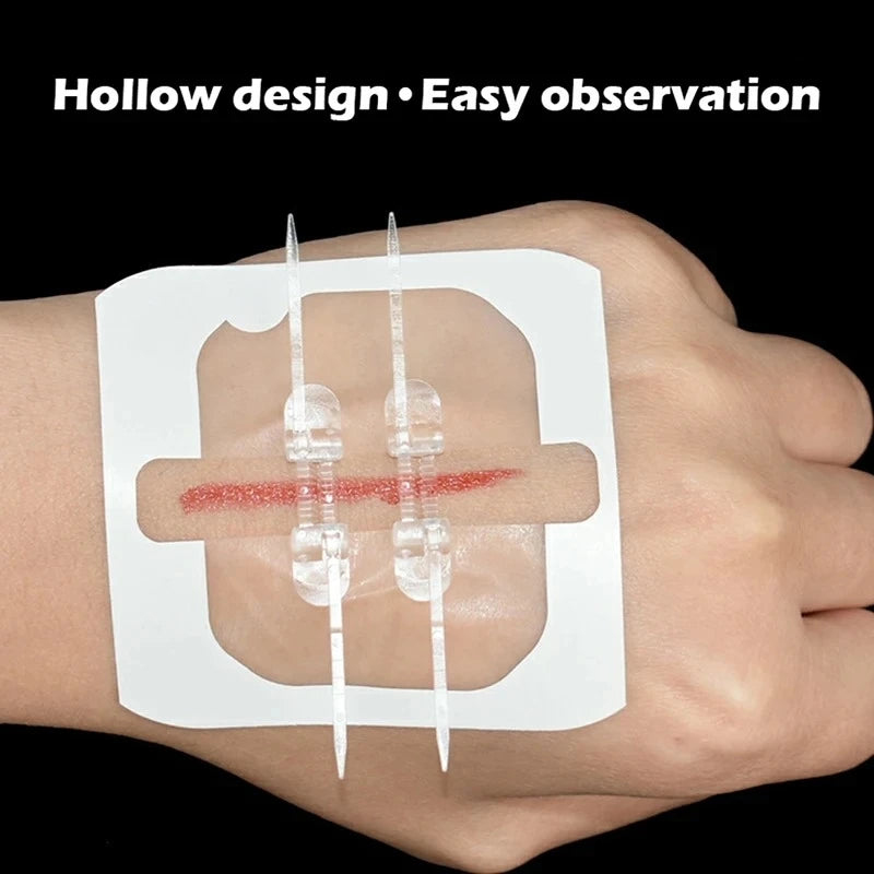 2-10 adhesive bandages with zipper, wound closure device, no need for sutures, quick and painless, outdoor medical care