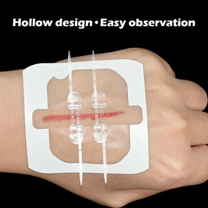 2-10 adhesive bandages with zipper, wound closure device, no need for sutures, quick and painless, outdoor medical care