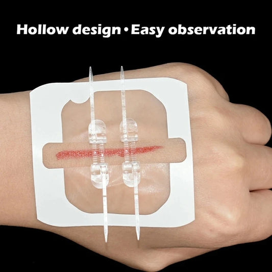 2-10 adhesive bandages with zipper, wound closure device, no need for sutures, quick and painless, outdoor medical care