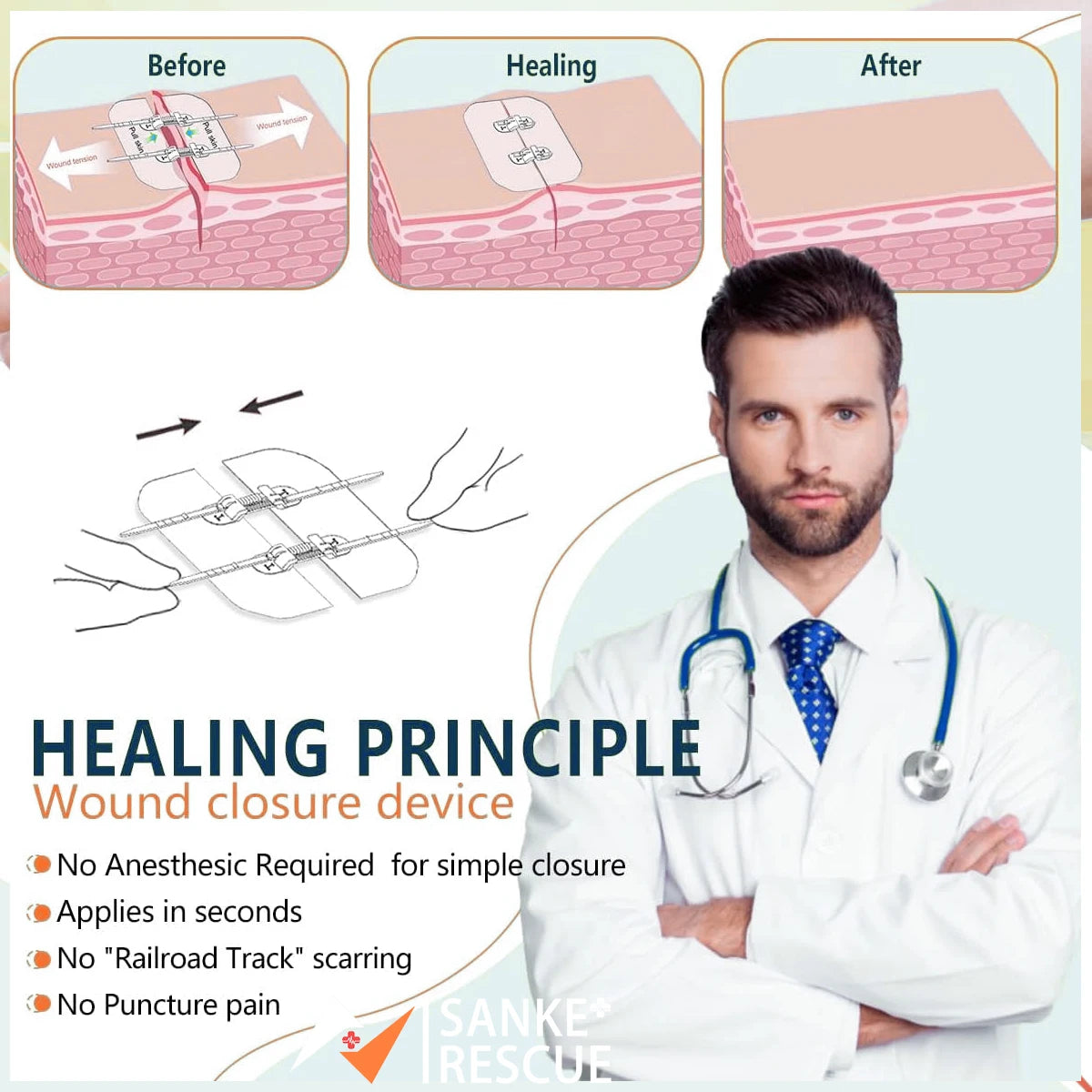 Zipper Band-aid Painless Wound Closure Device Suture-free Wound Dressing Patches Zip Suture Reducer Band Aid