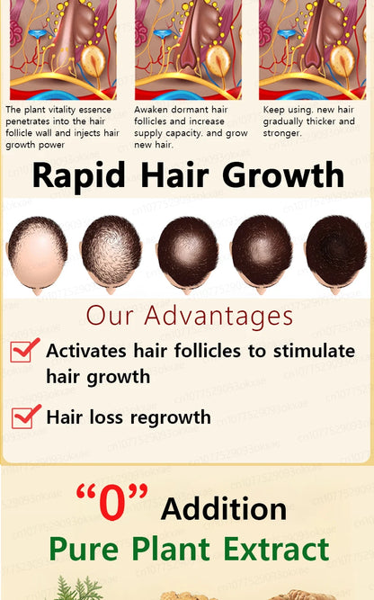 Want to say goodbye to hair loss? Our hair growth products can penetrate the scalp, promote hair growth, and help you regain you