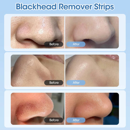 Nose Blackhead Remover Cream Pore Strip Tearing Mask Peeling Acne Cleaner Nasal Patch Black Dots Deep Deaning Skin Care Makeup