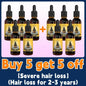 Want to say goodbye to hair loss? Our hair growth products can penetrate the scalp, promote hair growth, and help you regain you