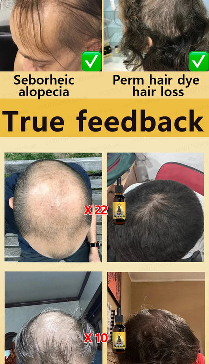 Want to say goodbye to hair loss? Our hair growth products can penetrate the scalp, promote hair growth, and help you regain you
