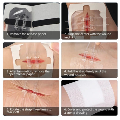 2-10 adhesive bandages with zipper, wound closure device, no need for sutures, quick and painless, outdoor medical care
