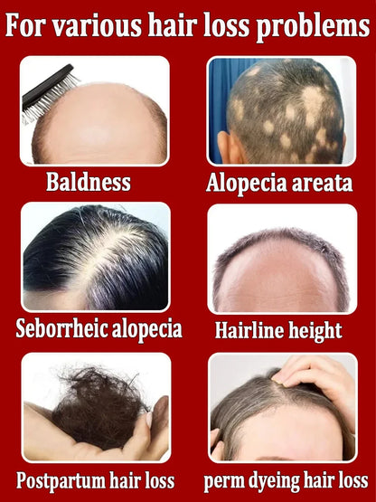 Want to say goodbye to hair loss? Our hair growth products can penetrate the scalp, promote hair growth, and help you regain you