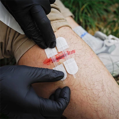 RHINO RESCUE Zip Stitch 6pcs with Wound Dresssings, Wound Closure Strips Without Suture, Zipstitch Laceration Closure Kit