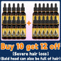 Want to say goodbye to hair loss? Our hair growth products can penetrate the scalp, promote hair growth, and help you regain you